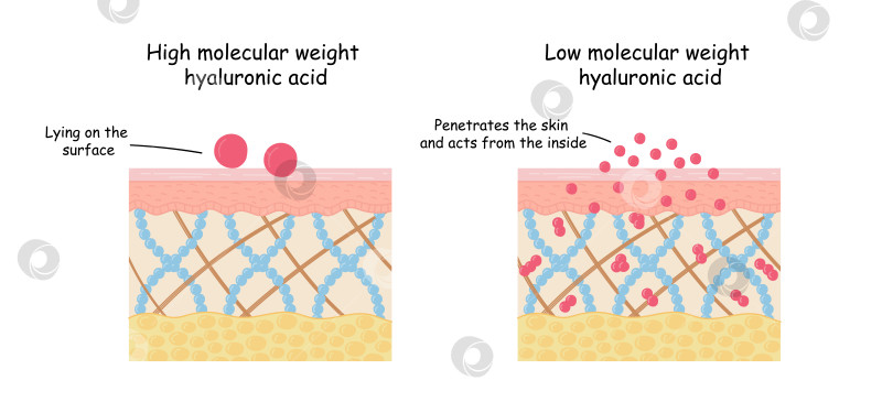 Скачать Низкомолекулярная гиалуроновая кислота, анатомия кожи. иллюстрация косметических процедур для лица фотосток Ozero