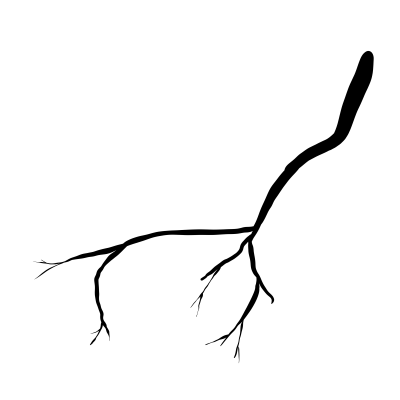 [object Object] undefined