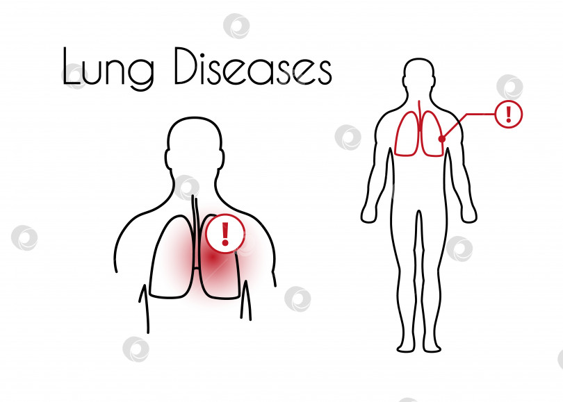 Скачать Векторные заболевания легких Линейный значок молодого человека фотосток Ozero