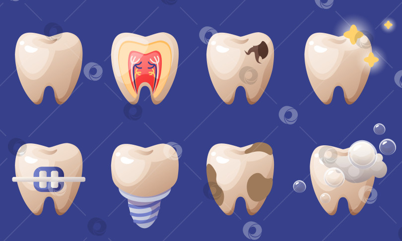 Скачать Векторный набор зубов. Проблемы с зубами, кариес, зубной камень, зубной налет, имплантаты, ортодонтические брекеты. Зубной налет на зубах, блестящие белые зубы. Гигиена полости рта и зубная боль, кариозные полости, трения, пятна и здоровые зубы. фотосток Ozero