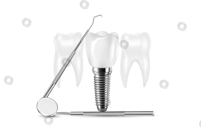 Скачать Структура зубного имплантата медицинский наглядный образовательный инфографический плакат с векторной иллюстрацией моделей здоровых инструментов для замены коренных зубов. фотосток Ozero