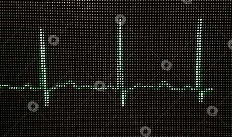 Скачать Фотография нормальной электрокардиограммы человека на мониторе крупным планом фотосток Ozero
