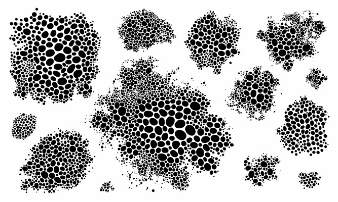 [object Object] undefined