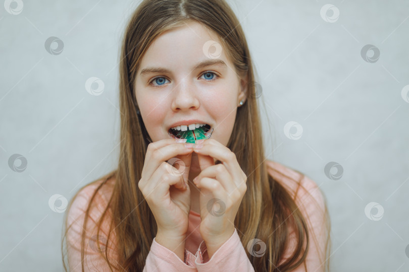 Скачать Зубная пластина. Расширение челюсти у ребенка. Не хватает места для коренных зубов. Счастливая девочка с ортодонтической пластиной в руках фотосток Ozero