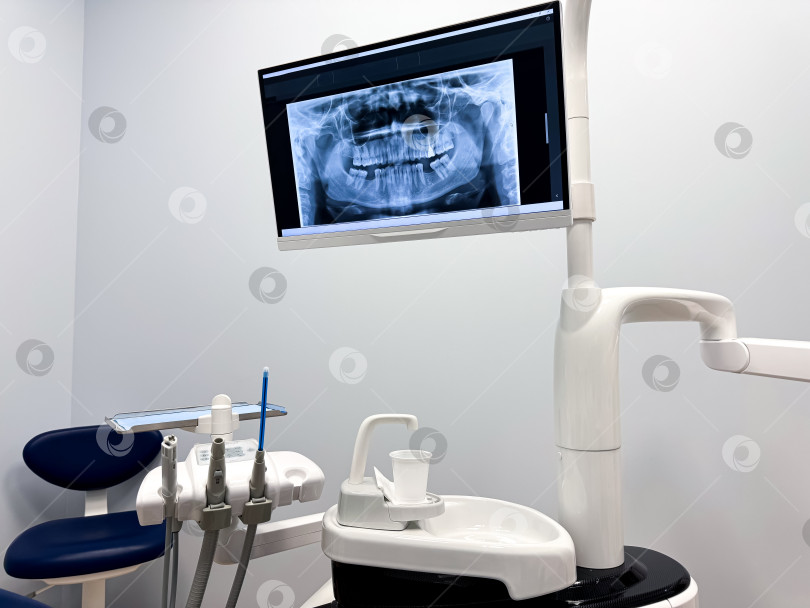 Скачать Стоматологический кабинет с рентгеновским дисплеем и оборудованием фотосток Ozero
