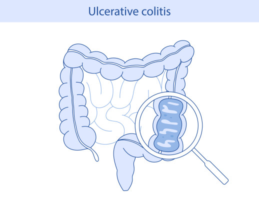 [object Object] undefined