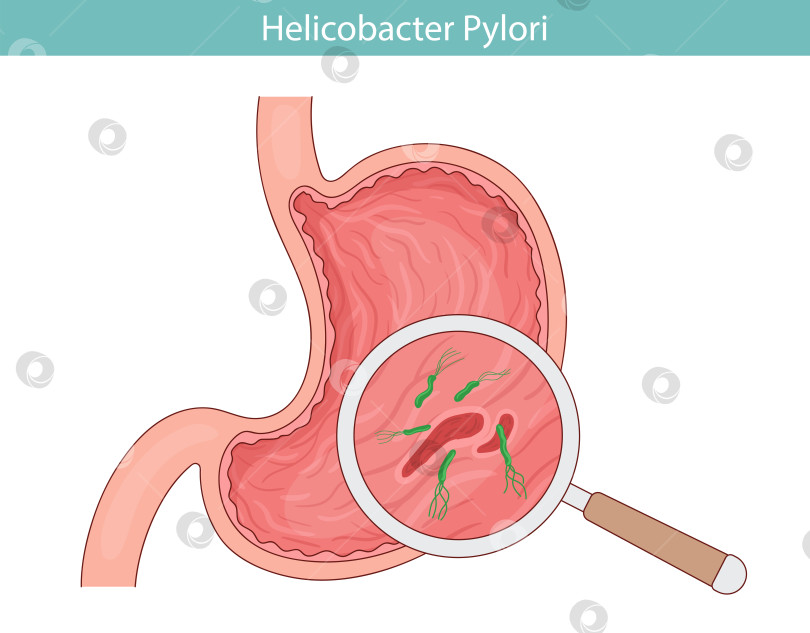 Скачать Зеленая бактерия Helicobacter pylori. заболевание желудка. Векторная иллюстрация в мультяшном стиле. фотосток Ozero