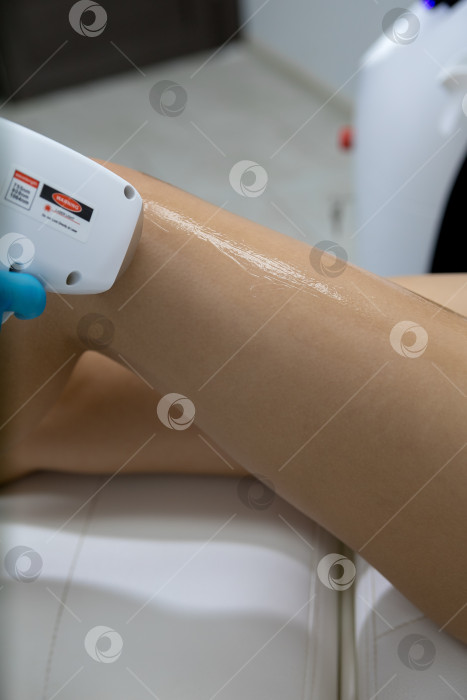 Скачать Процедура удаления волос. На кадре молодая подтянутая клиентка, проходящая процедуру лазерной эпиляции тела в клинике красоты. Концепция женской красоты и косметологии фотосток Ozero