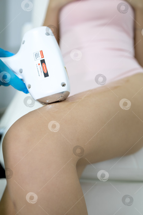 Скачать Процедура удаления волос. На кадре молодая подтянутая клиентка, проходящая процедуру лазерной эпиляции тела в клинике красоты. Концепция женской красоты и косметологии фотосток Ozero