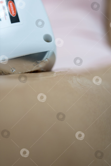 Скачать Процедура удаления волос. На кадре молодая подтянутая клиентка, проходящая процедуру лазерной эпиляции тела в клинике красоты. Концепция женской красоты и косметологии фотосток Ozero