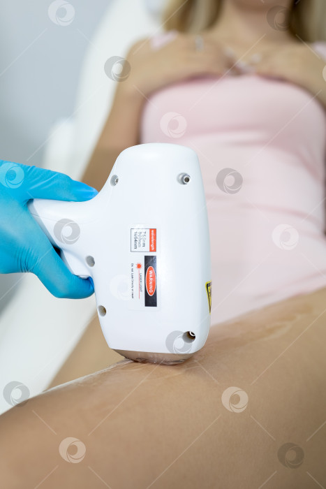 Скачать Процедура удаления волос. На кадре молодая подтянутая клиентка, проходящая процедуру лазерной эпиляции тела в клинике красоты. Концепция женской красоты и косметологии фотосток Ozero