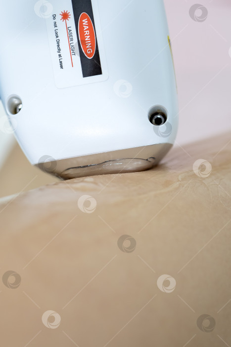 Скачать Процедура удаления волос. На кадре молодая подтянутая клиентка, проходящая процедуру лазерной эпиляции тела в клинике красоты. Концепция женской красоты и косметологии фотосток Ozero