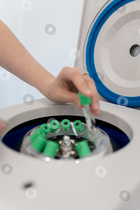 Скачать В руке медицинская пробирка с плазмой крови для PRP, извлеченной из центрифуги для плазмолифтинга.Процесс плазмолифтинга фотосток Ozero