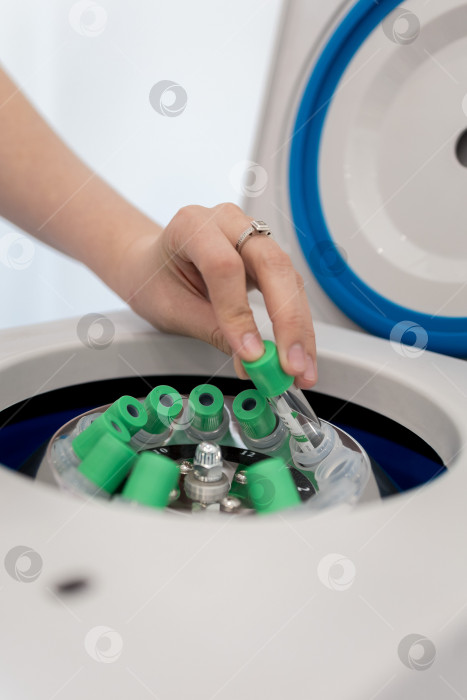 Скачать В руке медицинская пробирка с плазмой крови для PRP, извлеченной из центрифуги для плазмолифтинга.Процесс плазмолифтинга фотосток Ozero