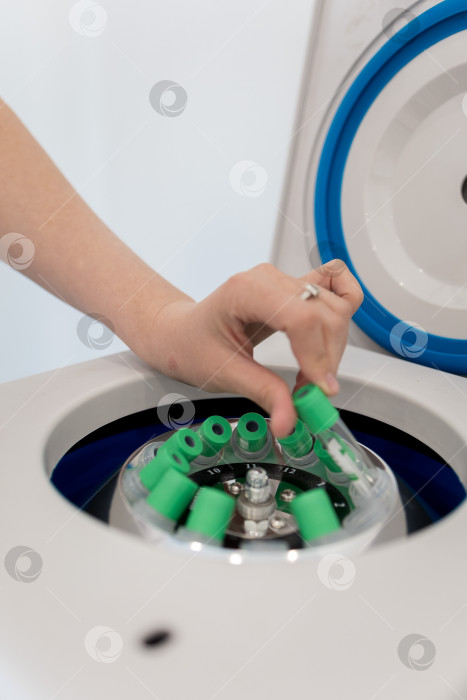 Скачать В руке медицинская пробирка с плазмой крови для PRP, извлеченной из центрифуги для плазмолифтинга.Процесс плазмолифтинга фотосток Ozero