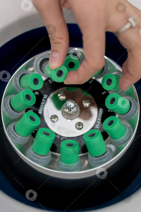 Скачать В руке медицинская пробирка с плазмой крови для PRP, извлеченной из центрифуги для плазмолифтинга.Процесс плазмолифтинга фотосток Ozero