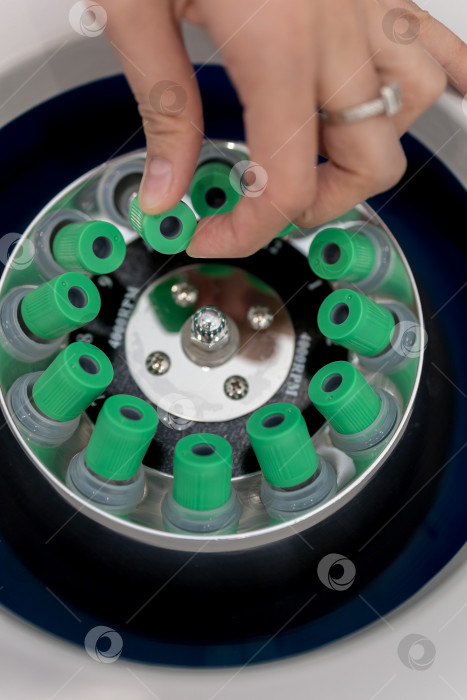 Скачать В руке медицинская пробирка с плазмой крови для PRP, извлеченной из центрифуги для плазмолифтинга.Процесс плазмолифтинга фотосток Ozero