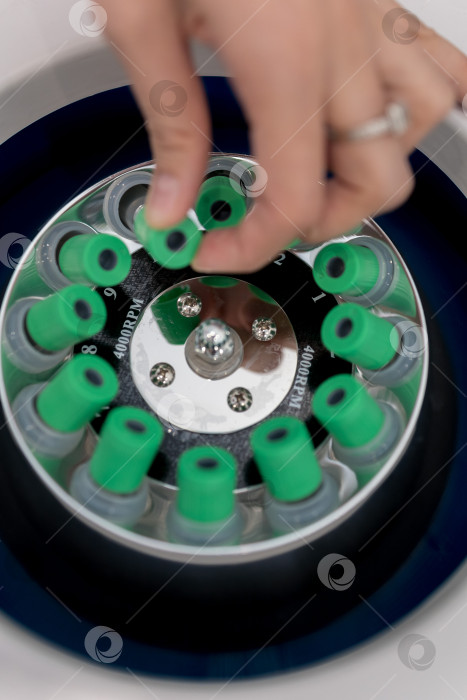 Скачать В руке медицинская пробирка с плазмой крови для PRP, извлеченной из центрифуги для плазмолифтинга.Процесс плазмолифтинга фотосток Ozero