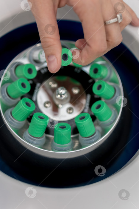 Скачать В руке медицинская пробирка с плазмой крови для PRP, извлеченной из центрифуги для плазмолифтинга.Процесс плазмолифтинга фотосток Ozero