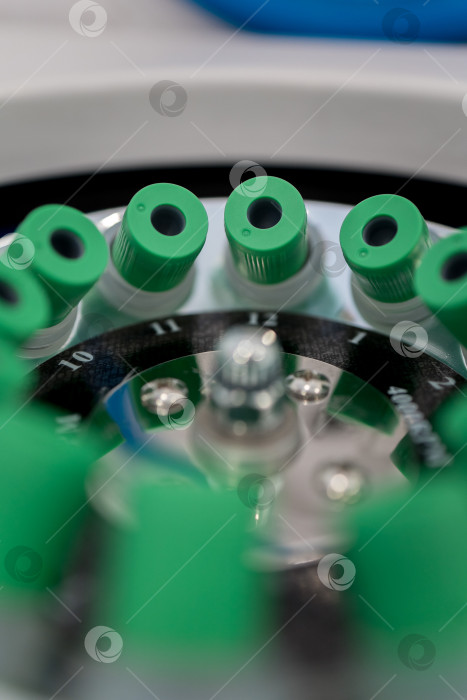 Скачать В руке медицинская пробирка с плазмой крови для PRP, извлеченной из центрифуги для плазмолифтинга.Процесс плазмолифтинга фотосток Ozero