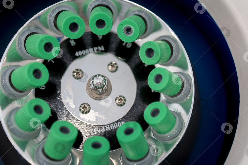 Скачать В руке медицинская пробирка с плазмой крови для PRP, извлеченной из центрифуги для плазмолифтинга.Процесс плазмолифтинга фотосток Ozero