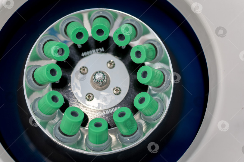 Скачать В руке медицинская пробирка с плазмой крови для PRP, извлеченной из центрифуги для плазмолифтинга.Процесс плазмолифтинга фотосток Ozero