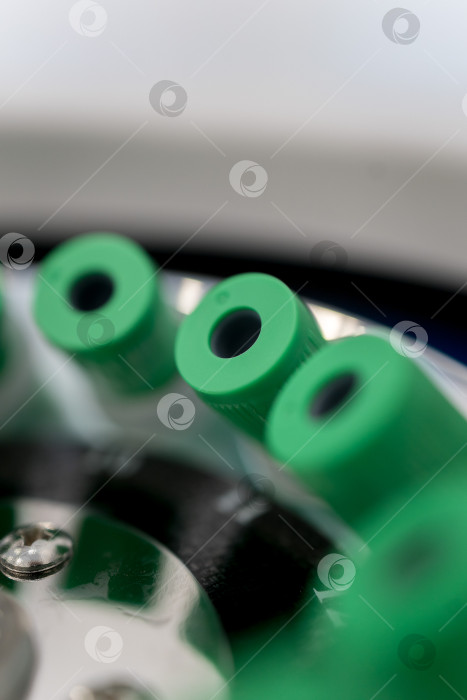 Скачать В руке медицинская пробирка с плазмой крови для PRP, извлеченной из центрифуги для плазмолифтинга.Процесс плазмолифтинга фотосток Ozero