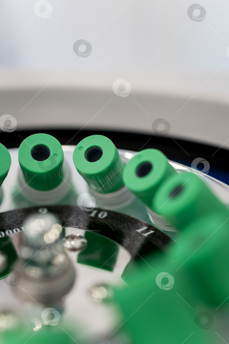 Скачать В руке медицинская пробирка с плазмой крови для PRP, извлеченной из центрифуги для плазмолифтинга.Процесс плазмолифтинга фотосток Ozero