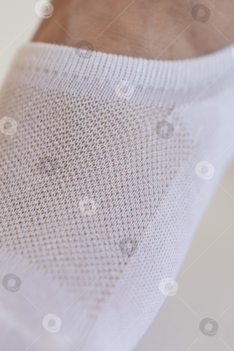 Скачать Женская ножка крупным планом в белом носке на белом фоне.Ткацкая ткань крупным планом. фотосток Ozero