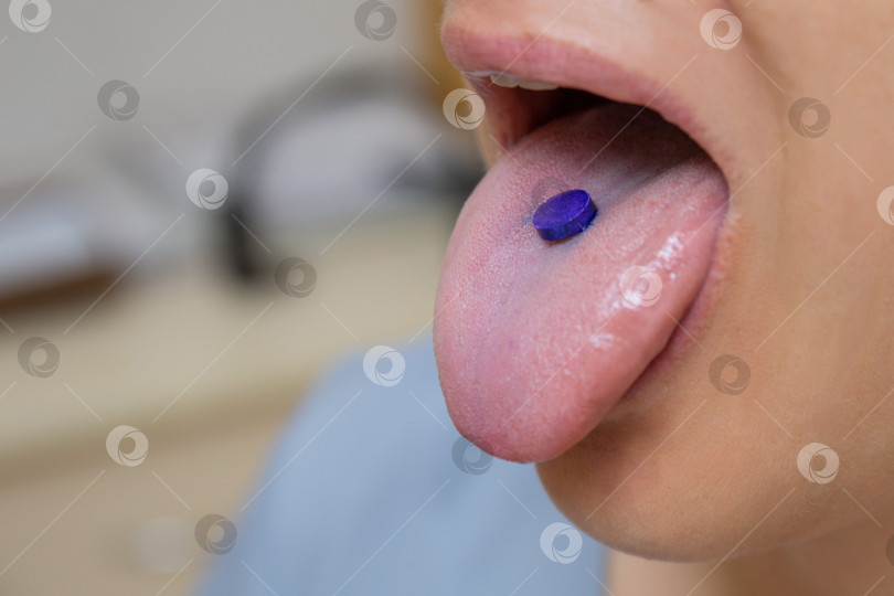Скачать Фиолетовая раскрывающаяся таблетка для обозначения налета на языке у женщины фотосток Ozero