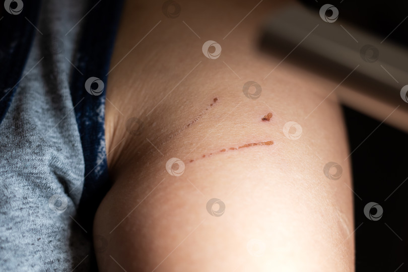 Скачать Детальное изображение кожи человека крупным планом, тщательно демонстрирующее видимые легкие шрамы и отчетливые отметины фотосток Ozero
