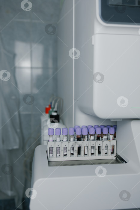 Скачать Пробирки с кровью фотосток Ozero