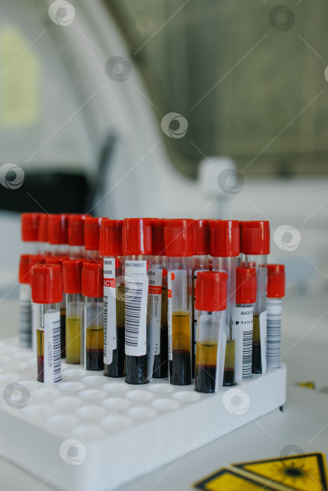Скачать Пробирки с кровью для биохимического анализа. фотосток Ozero