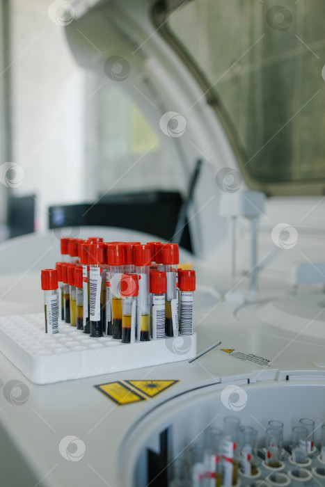 Скачать Пробирки с кровью для биохимического анализа. фотосток Ozero