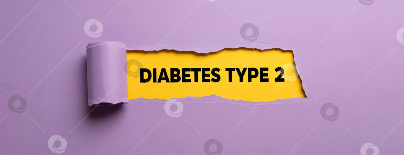 Скачать Фиолетовая бумага с разорванным отверстием, на котором виден текст "Сахарный диабет 2 типа", шаблон баннера для санитарного просвещения, информирования о хронических заболеваниях или кампании по профилактике с помощью copyspace. фотосток Ozero