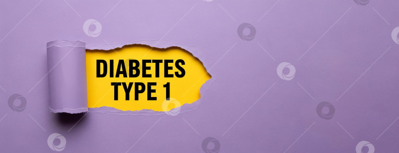 Скачать Фиолетовая бумага с разорванным отверстием, на котором виден текст "Сахарный диабет 1 типа", шаблон баннера для санитарного просвещения, информирования о хронических заболеваниях или кампании по профилактике с помощью copyspace. фотосток Ozero