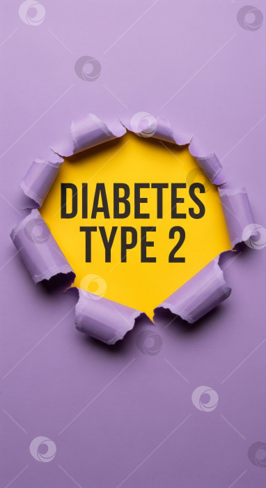 Скачать Фиолетовая бумага с оторванным отверстием, на котором видны слова "Диабет 2-го типа" для медицинского просвещения по вопросам здоровья и хронических заболеваний. Вертикальный дизайн для информирования о рисках диабета. фотосток Ozero