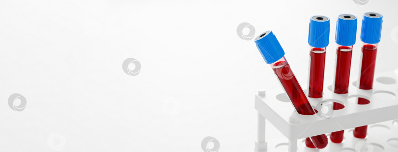 Скачать Пробирки с кровью в подставке для медицинских диагностических исследований на светлом фоне. фотосток Ozero