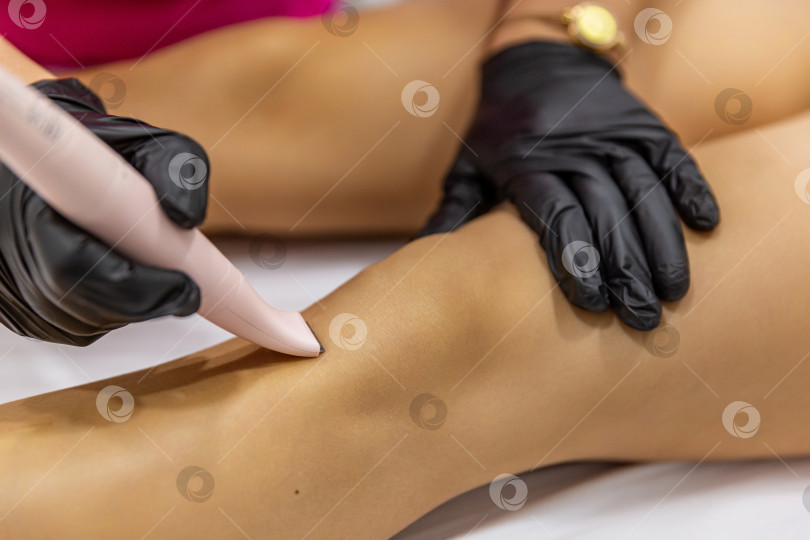 Скачать Процедура эпиляции фотосток Ozero