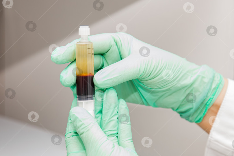 Скачать Косметолог в белом халате и перчатках проверяет и демонстрирует пробирку для взятия крови с центрифугированной отделенной кровью, богатой тромбоцитами и плазмой фотосток Ozero