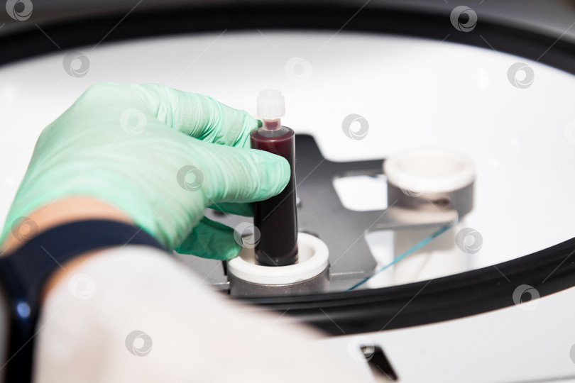 Скачать Пробирки, наполненные кровью, находятся в центрифуге для плазмолифтинга в лаборатории фотосток Ozero