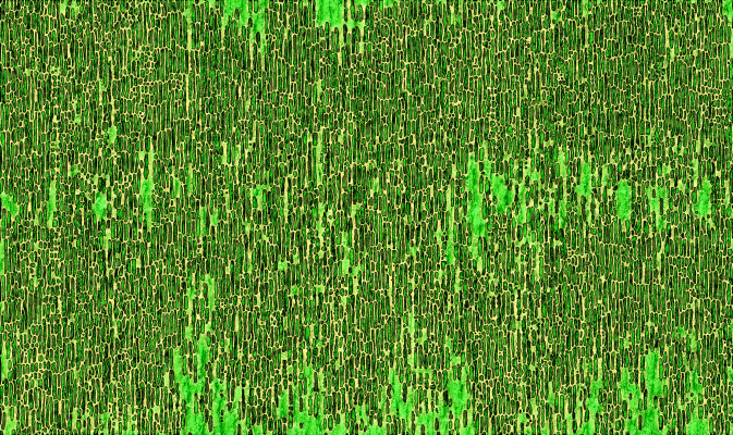 [object Object] undefined