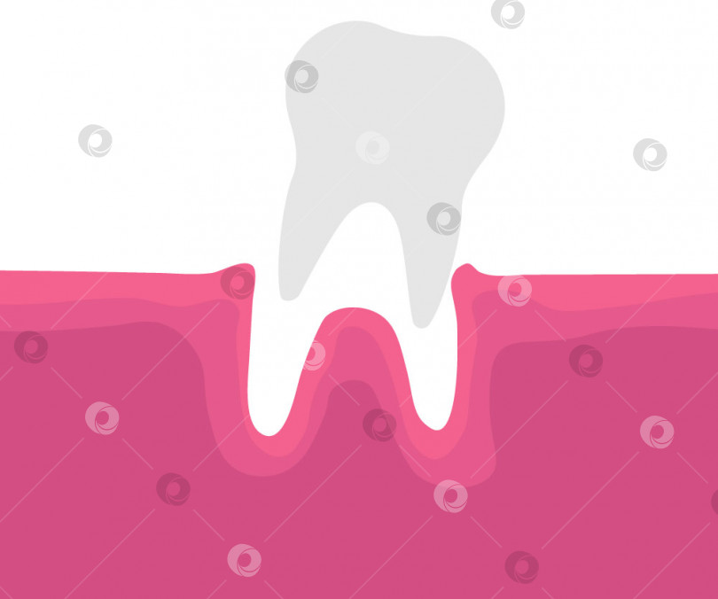 Скачать Иллюстрация потери зубов. Векторная иллюстрация фотосток Ozero