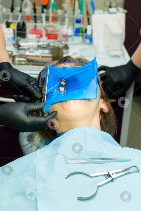 Скачать Изолируйте зубы пациента резиновой прокладкой. фотосток Ozero
