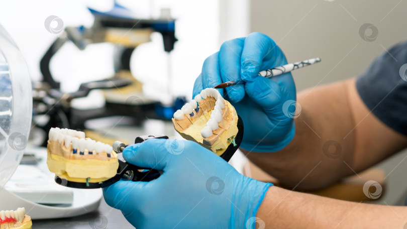Скачать Работа по протезированию зубов. Покраска зубов. фотосток Ozero
