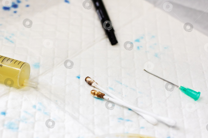 Скачать Выброшенные шприцы и зараженные расходные материалы, представляющие угрозу общественному здоровью и безопасности фотосток Ozero