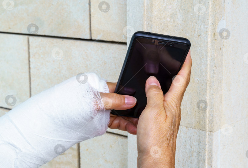 Скачать Женская рука в белой гипсовой повязке держит мобильный телефон фотосток Ozero