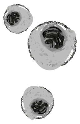 [object Object] undefined