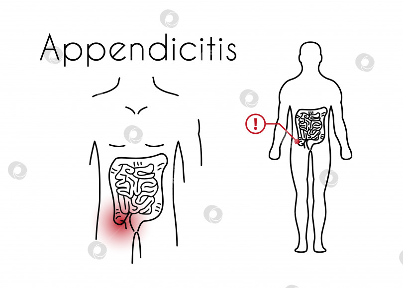 Скачать Векторный линейный значок аппендицита молодого человека фотосток Ozero