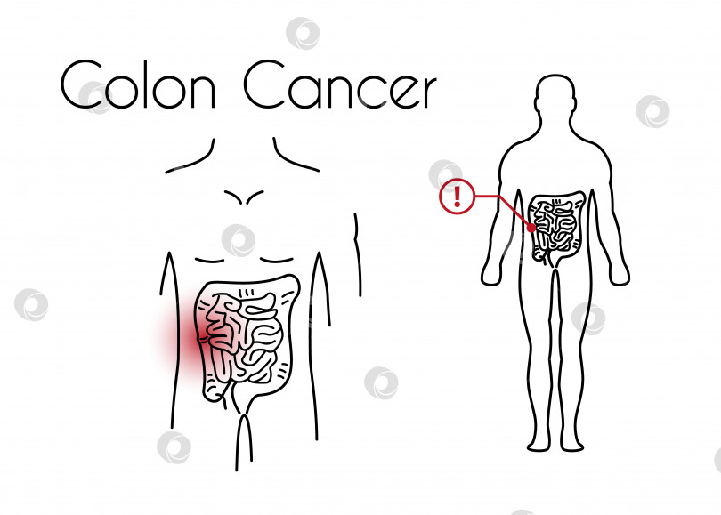 Скачать Векторный рак толстой кишки Линейный значок молодого человека фотосток Ozero